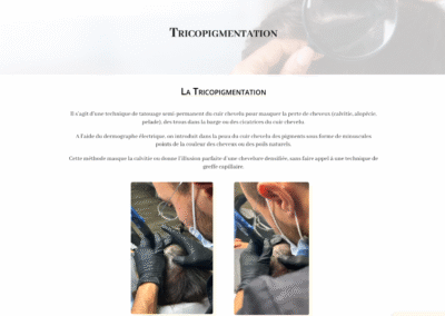 site By Guillaume page tricopigmentation